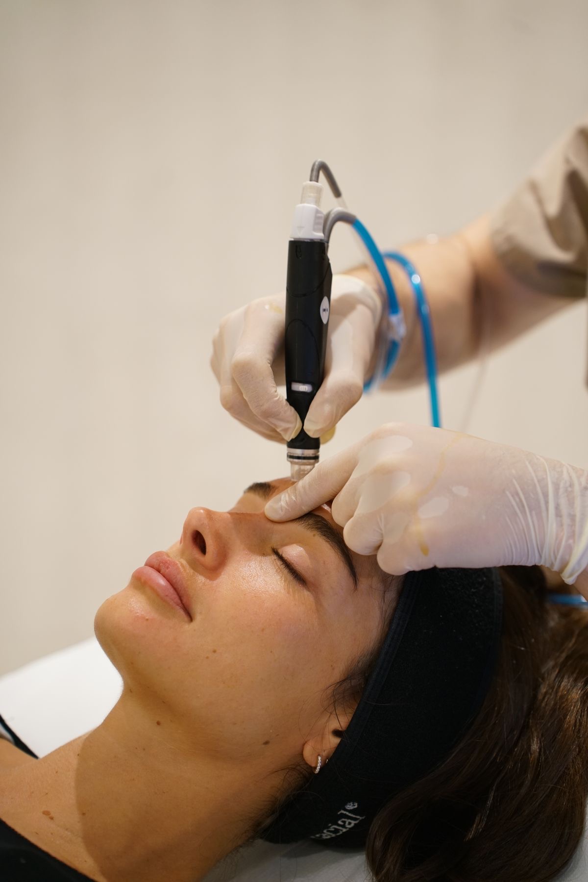 HydraFacial treatment